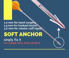 Suture Anchor - Soft