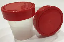 Sterile Urine Sample Cup